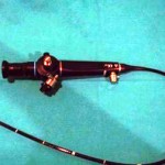 fibroscopio_fibrobroncoscopio_flexible